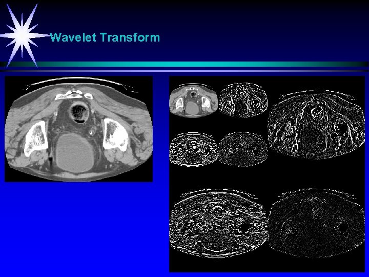 Wavelet Transform 