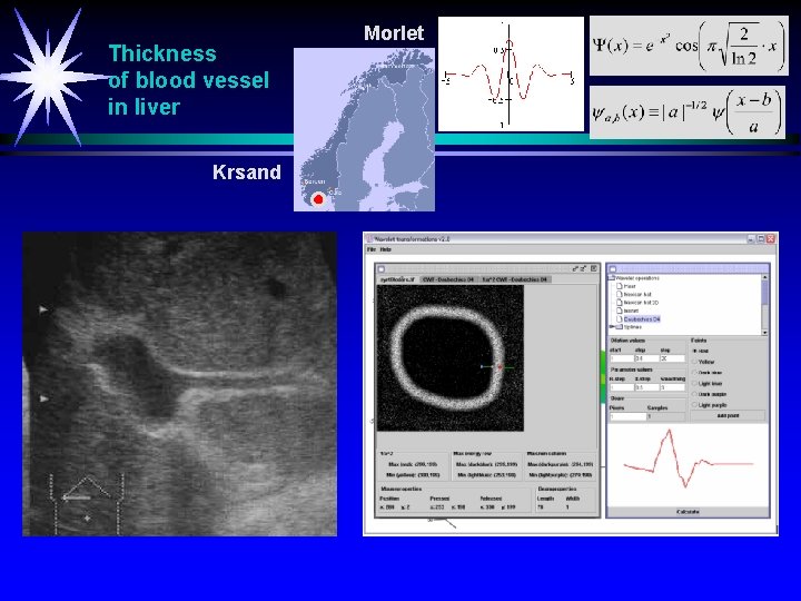 Thickness of blood vessel in liver Krsand Morlet 