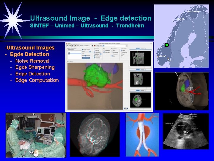 Ultrasound Image - Edge detection SINTEF – Unimed – Ultrasound - Trondheim -Ultrasound Images