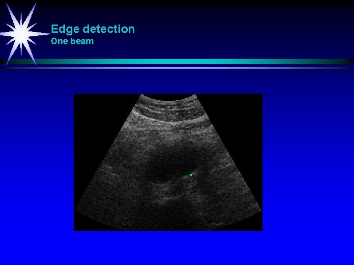 Edge detection One beam 