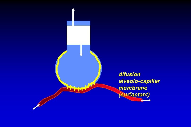 difusion alveolo-capillar membrane (surfactant) 