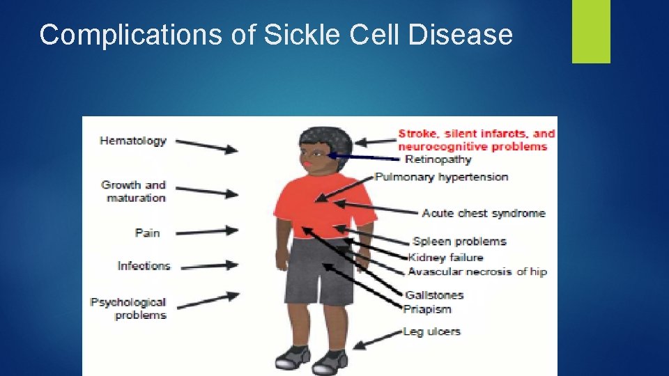 Complications of Sickle Cell Disease 