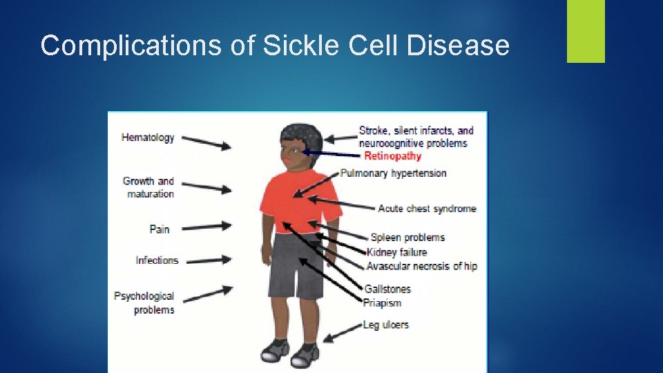 Complications of Sickle Cell Disease 