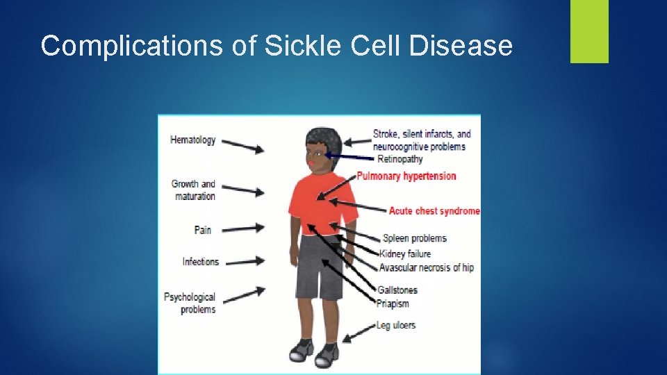 Complications of Sickle Cell Disease 