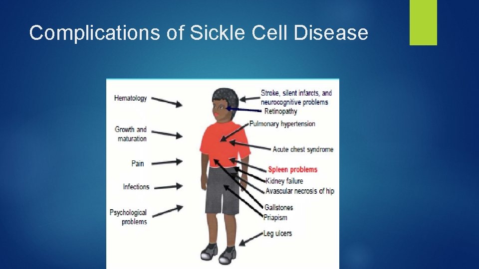 Complications of Sickle Cell Disease 