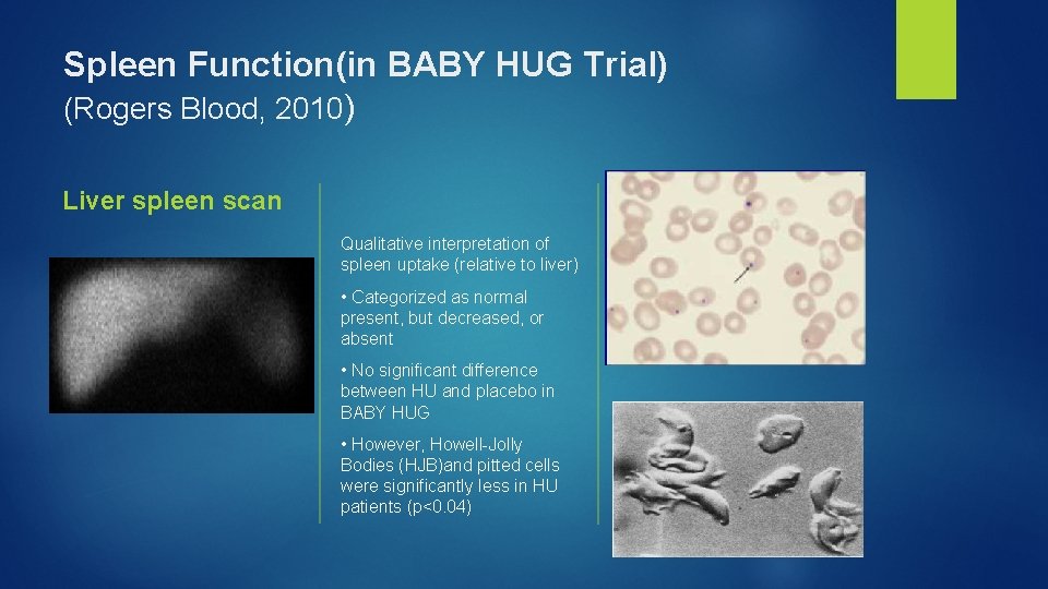 Spleen Function(in BABY HUG Trial) (Rogers Blood, 2010) Liver spleen scan Qualitative interpretation of