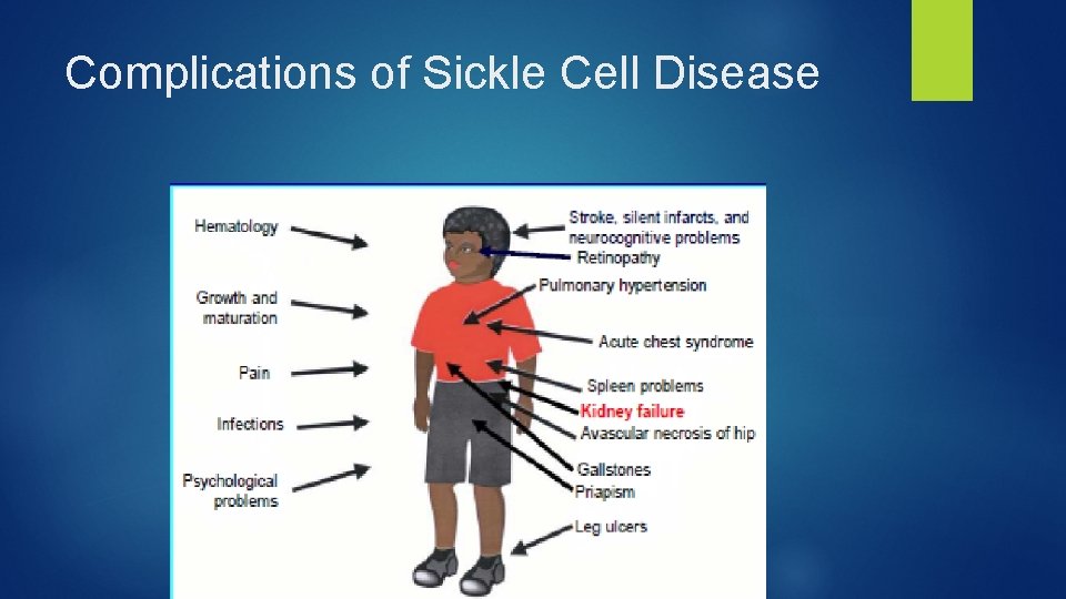 Complications of Sickle Cell Disease 