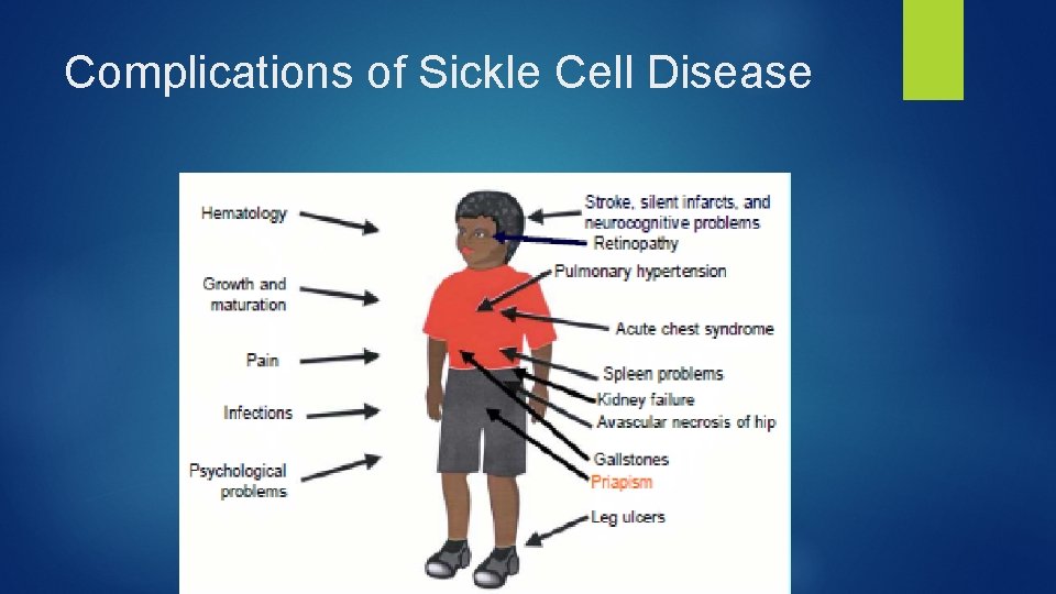 Complications of Sickle Cell Disease 