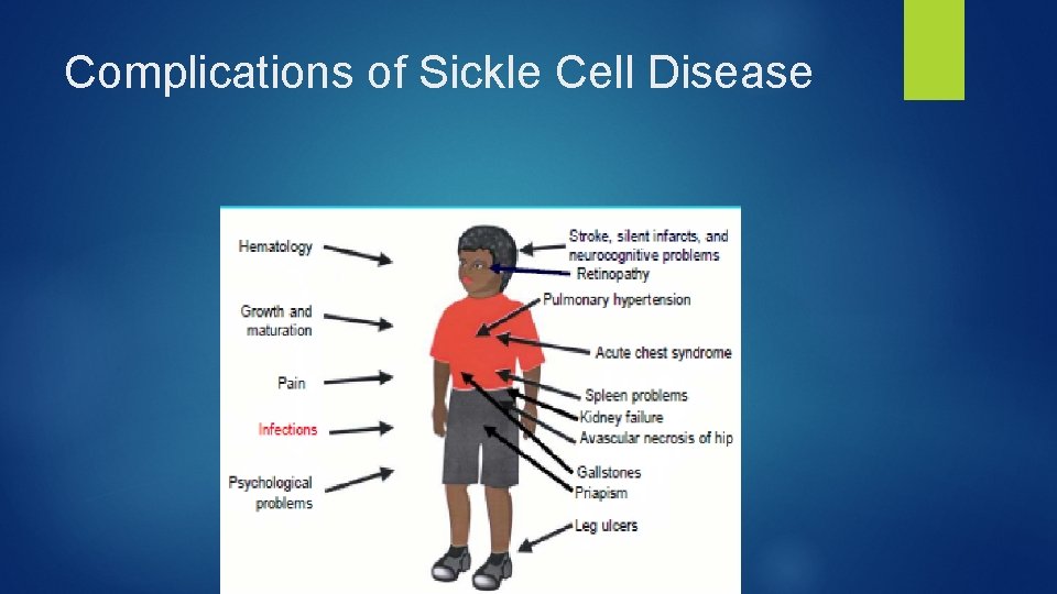 Complications of Sickle Cell Disease 