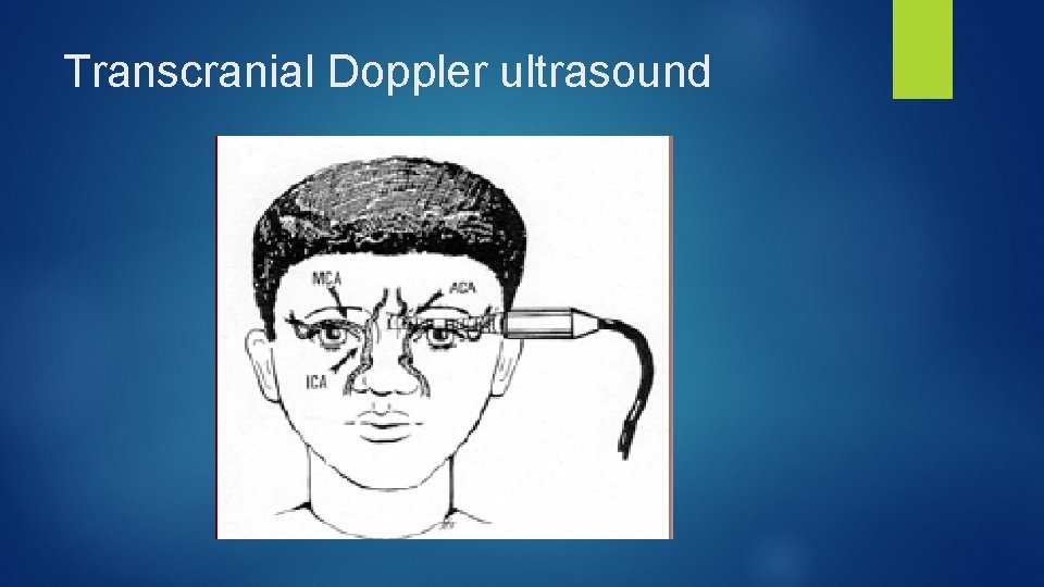 Transcranial Doppler ultrasound 