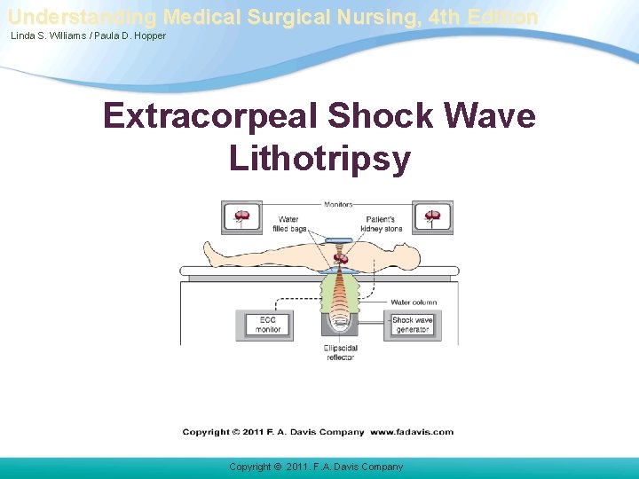 Understanding Medical Surgical Nursing, 4 th Edition Linda S. Williams / Paula D. Hopper Understanding Medical Surgical Nursing, 4 th Edition Linda S. Williams / Paula D. Hopper