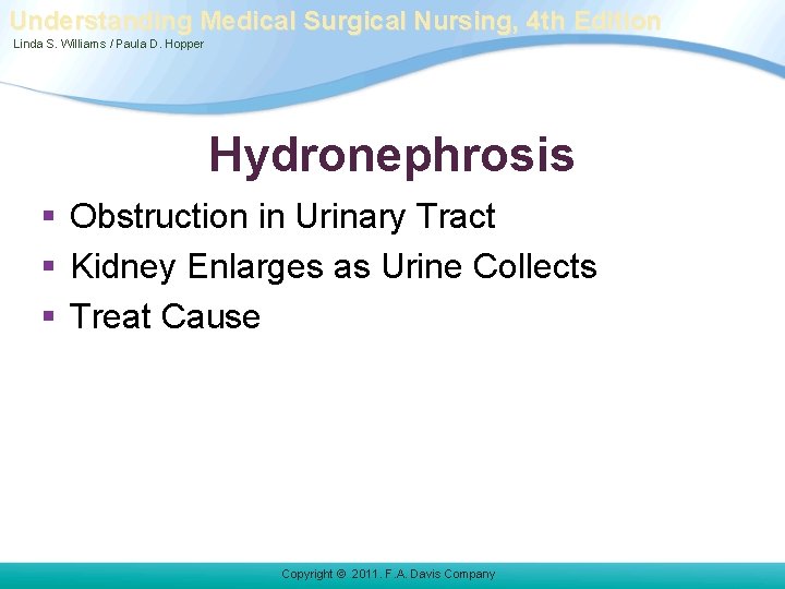 Understanding Medical Surgical Nursing, 4 th Edition Linda S. Williams / Paula D. Hopper Understanding Medical Surgical Nursing, 4 th Edition Linda S. Williams / Paula D. Hopper