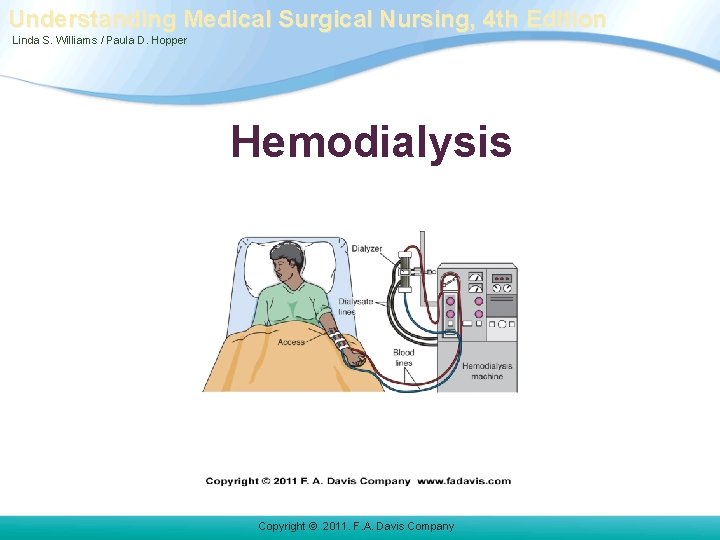 Understanding Medical Surgical Nursing, 4 th Edition Linda S. Williams / Paula D. Hopper Understanding Medical Surgical Nursing, 4 th Edition Linda S. Williams / Paula D. Hopper