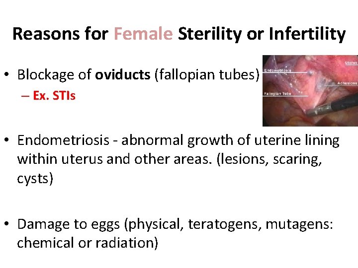 Reasons for Female Sterility or Infertility • Blockage of oviducts (fallopian tubes) – Ex.