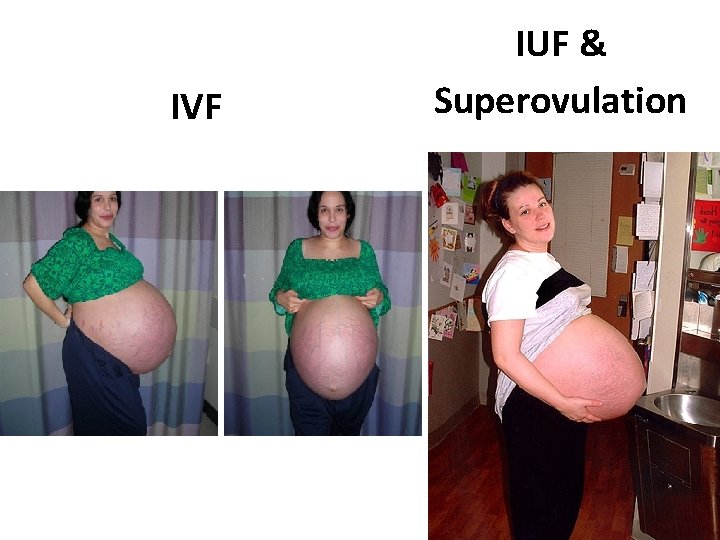 IVF IUF & Superovulation IVF IUF & Superovulation