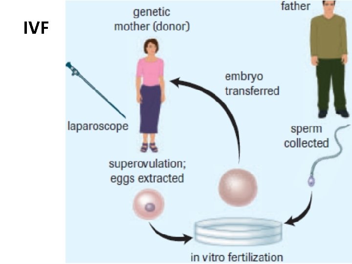 IVF 