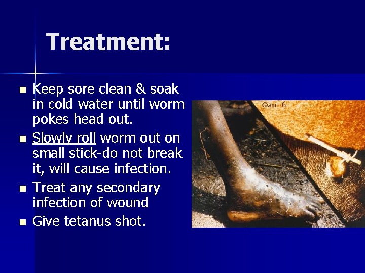 Treatment: n n Keep sore clean & soak in cold water until worm pokes