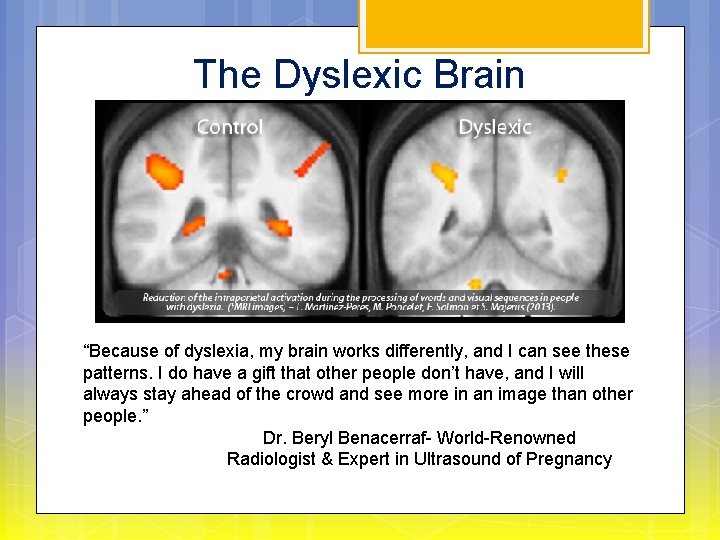 The Dyslexic Brain “Because of dyslexia, my brain works differently, and I can see