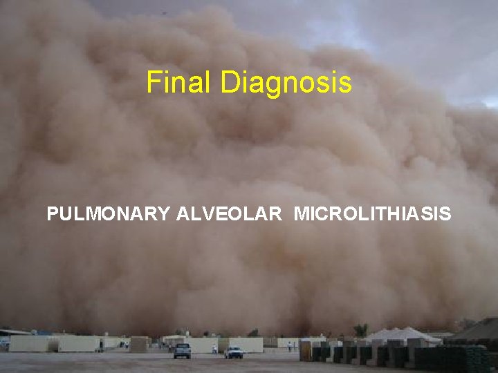 Final Diagnosis PULMONARY ALVEOLAR MICROLITHIASIS Final Diagnosis PULMONARY ALVEOLAR MICROLITHIASIS