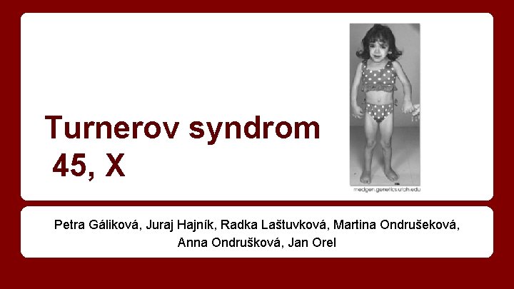 Turnerov syndrom 45, X Petra Gáliková, Juraj Hajník, Radka Laštuvková, Martina Ondrušeková, Anna Ondrušková,
