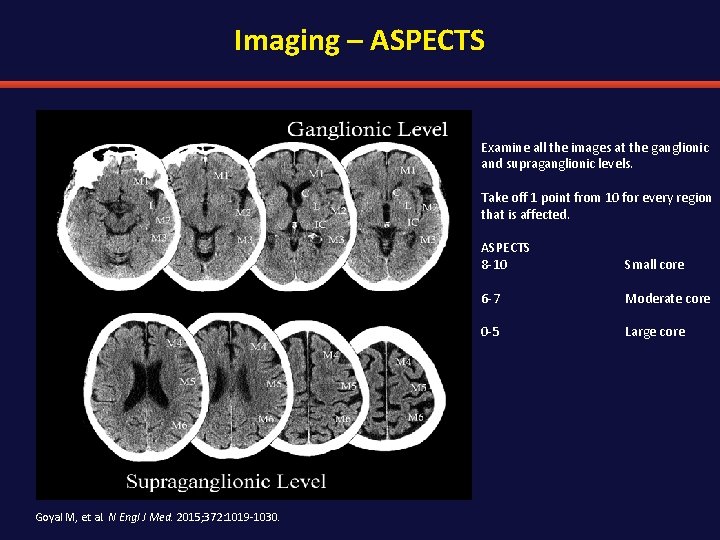 Imaging – ASPECTS Examine all the images at the ganglionic and supraganglionic levels. Take