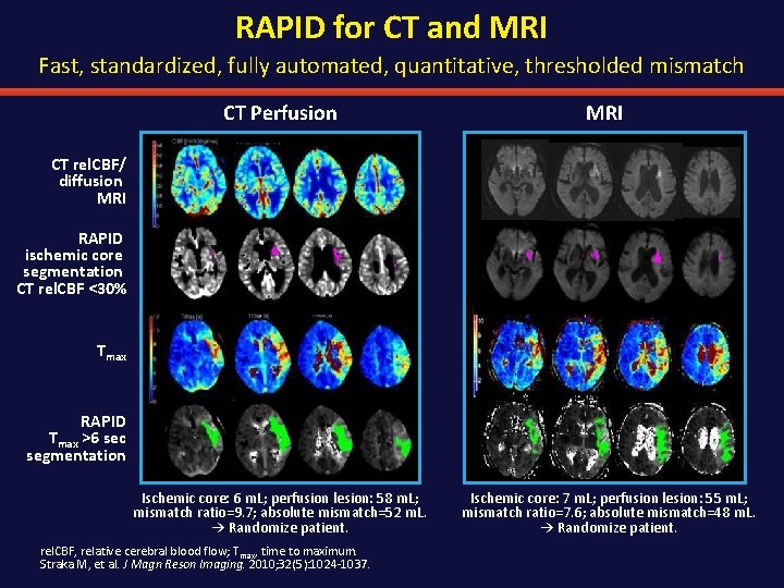 RAPID for CT and MRI Fast, standardized, fully automated, quantitative, thresholded mismatch CT Perfusion