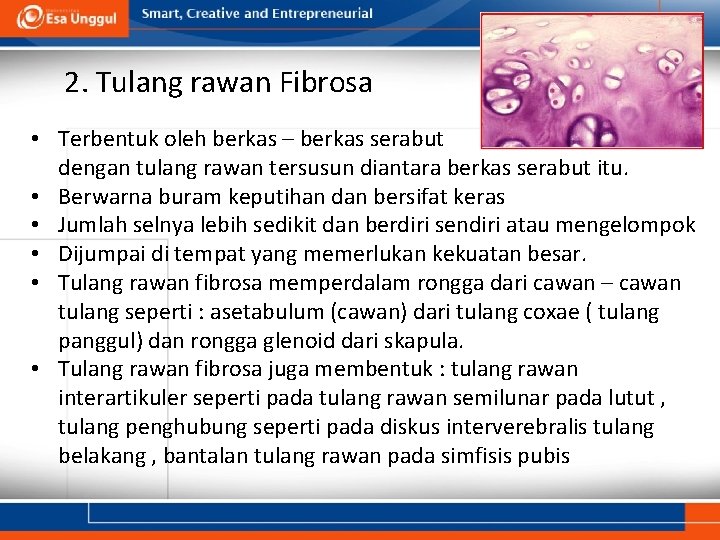 2. Tulang rawan Fibrosa • Terbentuk oleh berkas – berkas serabut dengan tulang rawan