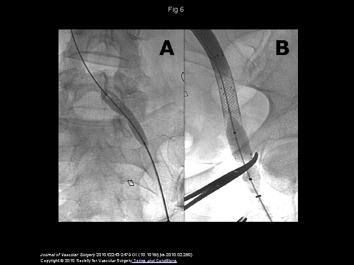 Fig 6 Journal of Vascular Surgery 2010 52243 -247 DOI: (10. 1016/j. jvs. 2010.