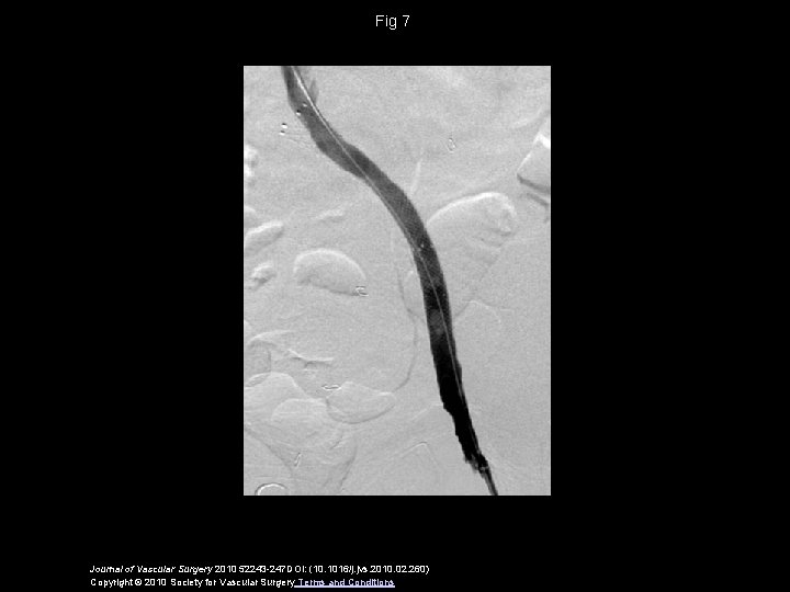 Fig 7 Journal of Vascular Surgery 2010 52243 -247 DOI: (10. 1016/j. jvs. 2010.