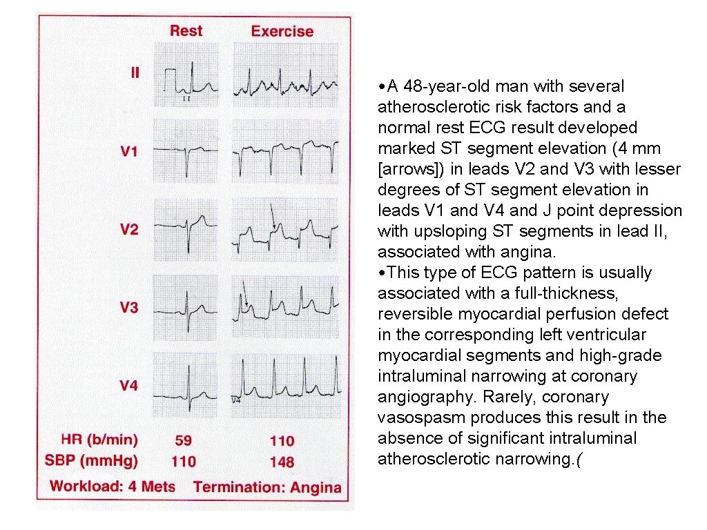  • A 48 -year-old man with several atherosclerotic risk factors and a normal