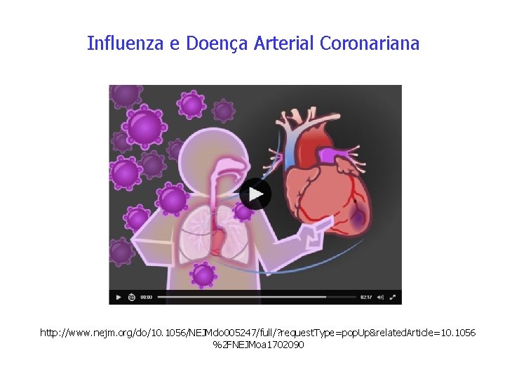 Influenza e Doença Arterial Coronariana http: //www. nejm. org/do/10. 1056/NEJMdo 005247/full/? request. Type=pop. Up&related.