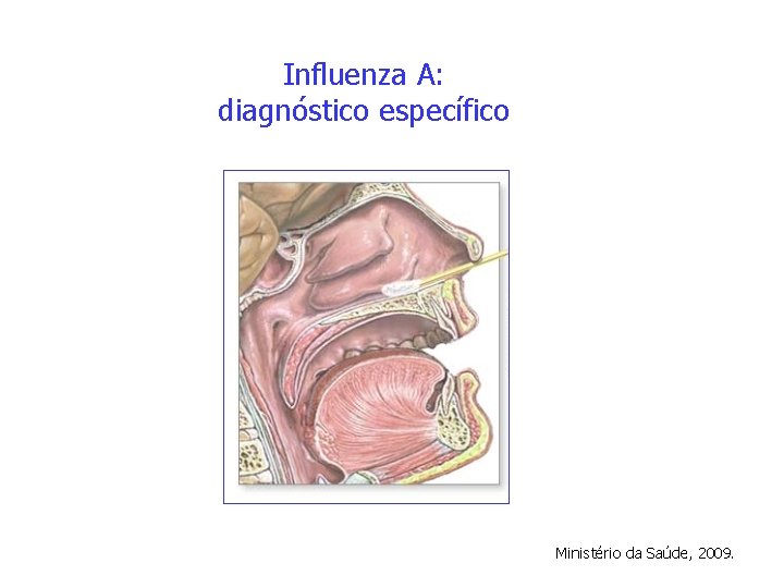 Influenza A: diagnóstico específico Ministério da Saúde, 2009. 