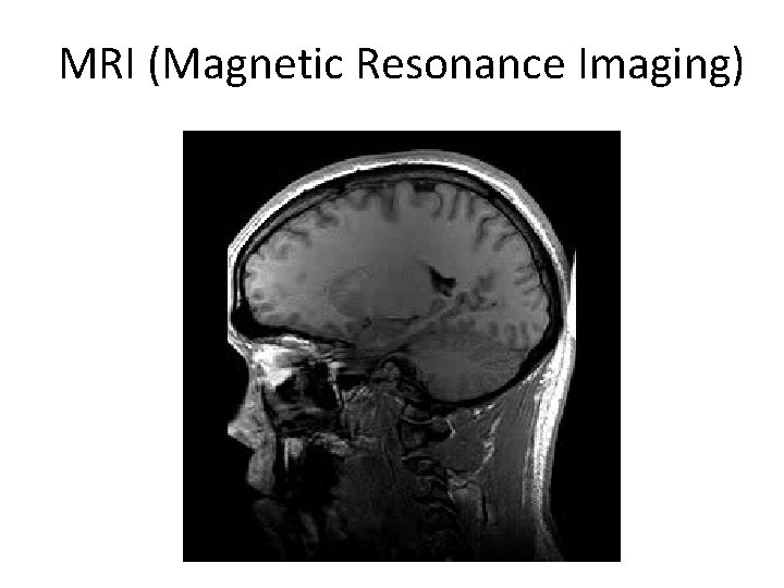MRI (Magnetic Resonance Imaging) 