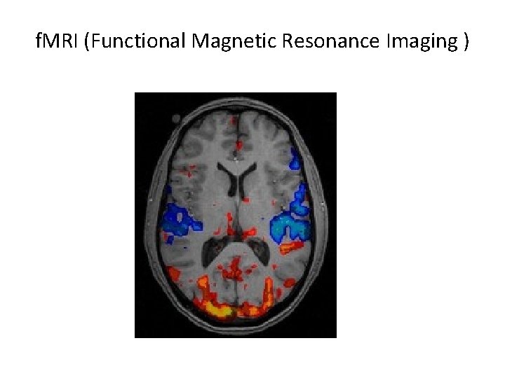 f. MRI (Functional Magnetic Resonance Imaging ) 