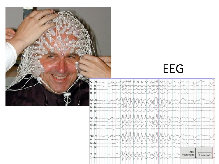 EEG 