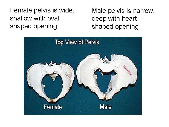 Female pelvis is wide, shallow with oval shaped opening Male pelvis is narrow, deep