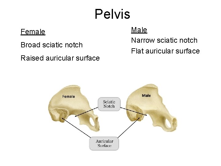 Pelvis Female Broad sciatic notch Raised auricular surface Male Narrow sciatic notch Flat auricular