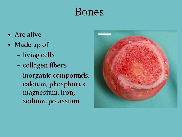 Bones • Are alive • Made up of – living cells – collagen fibers