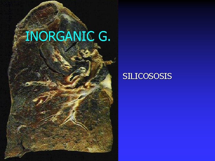  INORGANIC G. SILICOSOSIS 