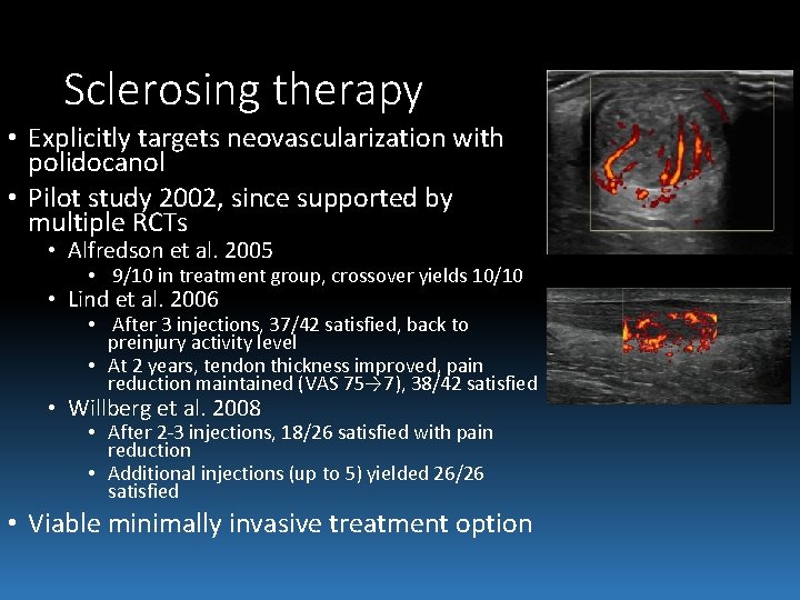 Sclerosing therapy • Explicitly targets neovascularization with polidocanol • Pilot study 2002, since supported