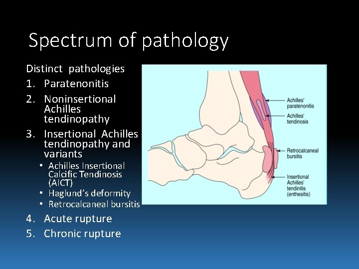 Spectrum of pathology Distinct pathologies 1. Paratenonitis 2. Noninsertional Achilles tendinopathy 3. Insertional Achilles