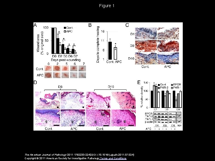 Figure 1 The American Journal of Pathology 2011 1792233 -2242 DOI: (10. 1016/j. ajpath.