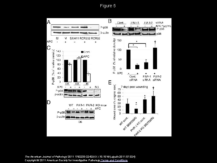 Figure 5 The American Journal of Pathology 2011 1792233 -2242 DOI: (10. 1016/j. ajpath.