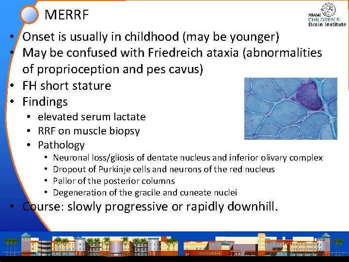 MERRF • Onset is usually in childhood (may be younger) • May be confused MERRF • Onset is usually in childhood (may be younger) • May be confused