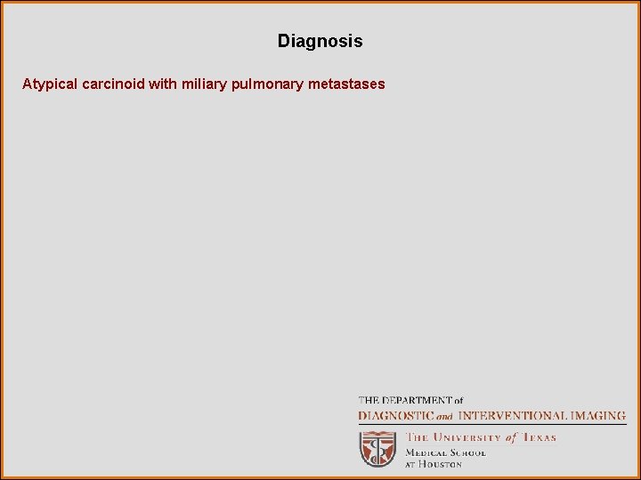 Diagnosis Atypical carcinoid with miliary pulmonary metastases 