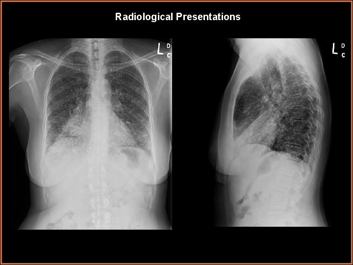 Radiological Presentations Radiological Presentations