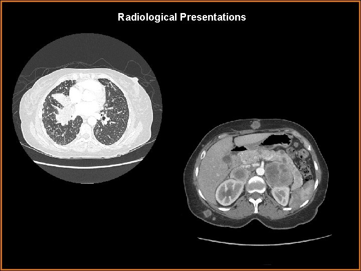Radiological Presentations Radiological Presentations