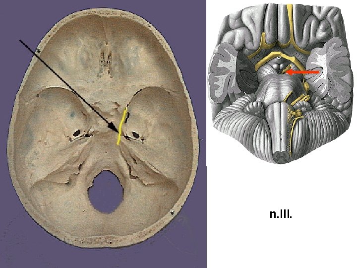 n. III. 
