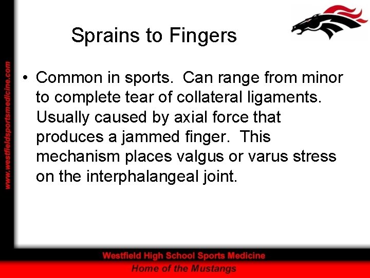 Sprains to Fingers • Common in sports. Can range from minor to complete tear