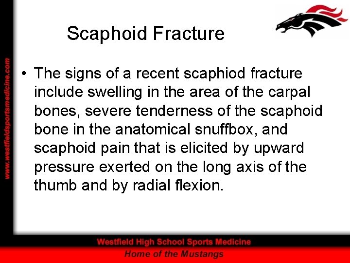 Scaphoid Fracture • The signs of a recent scaphiod fracture include swelling in the